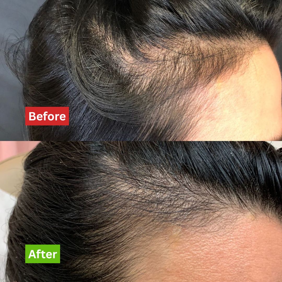 Intense Hair Growth Oil