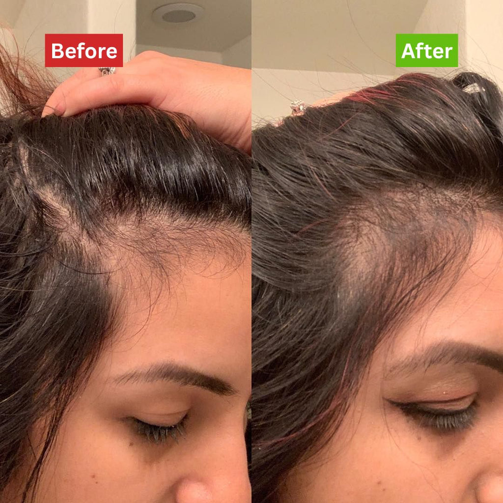 Intense Hair Growth Oil