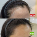 Intense Hair Growth Oil