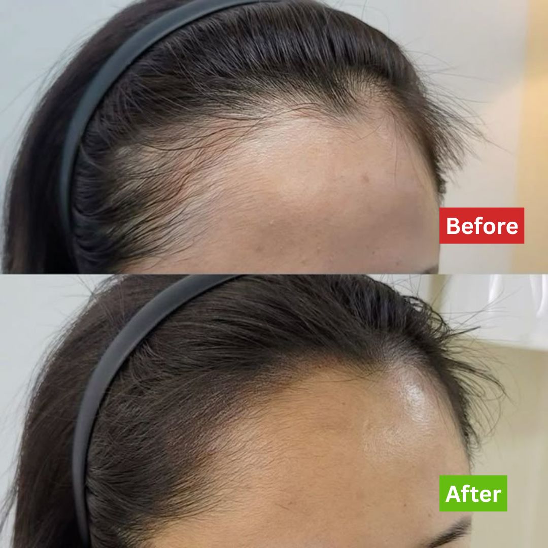 Intense Hair Growth Oil