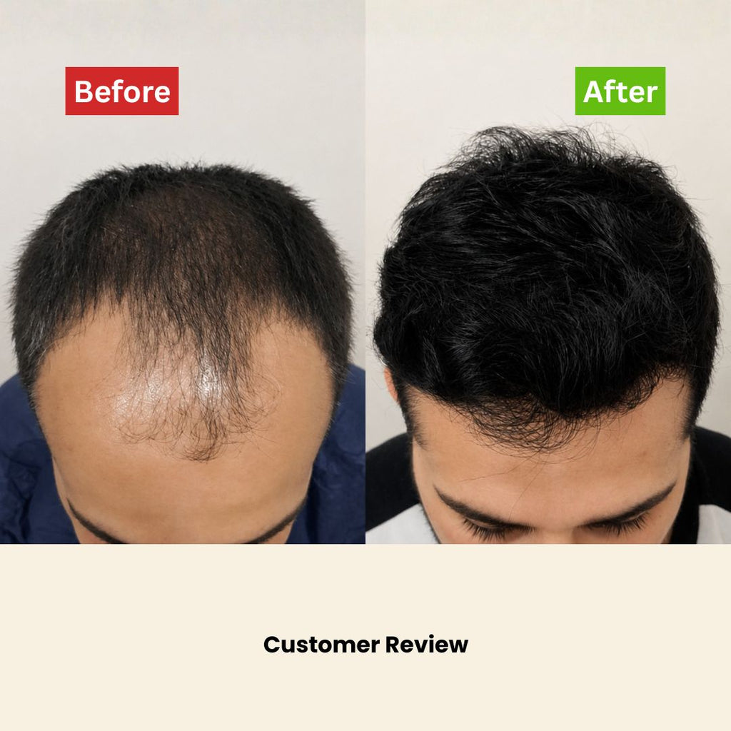Intense Hair Growth Oil