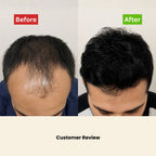 Intense Hair Growth Oil