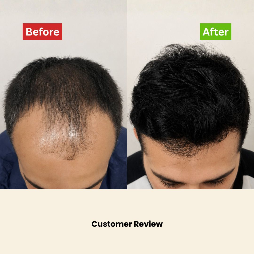 Intense Hair Growth Oil